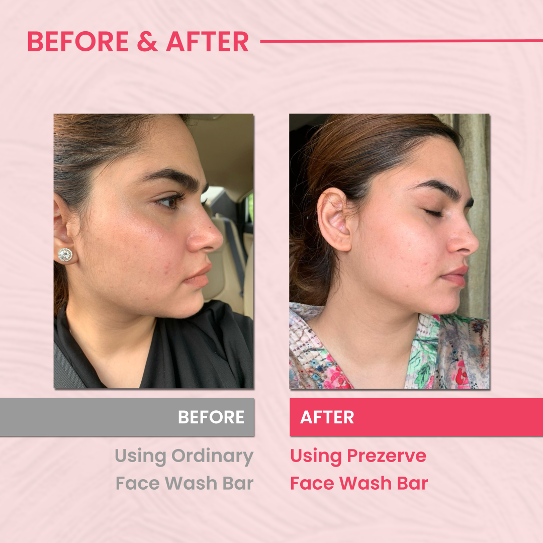 Prezerve Clarifying Mini Face Wash for Oily Skin- Gentle & pH Balanced