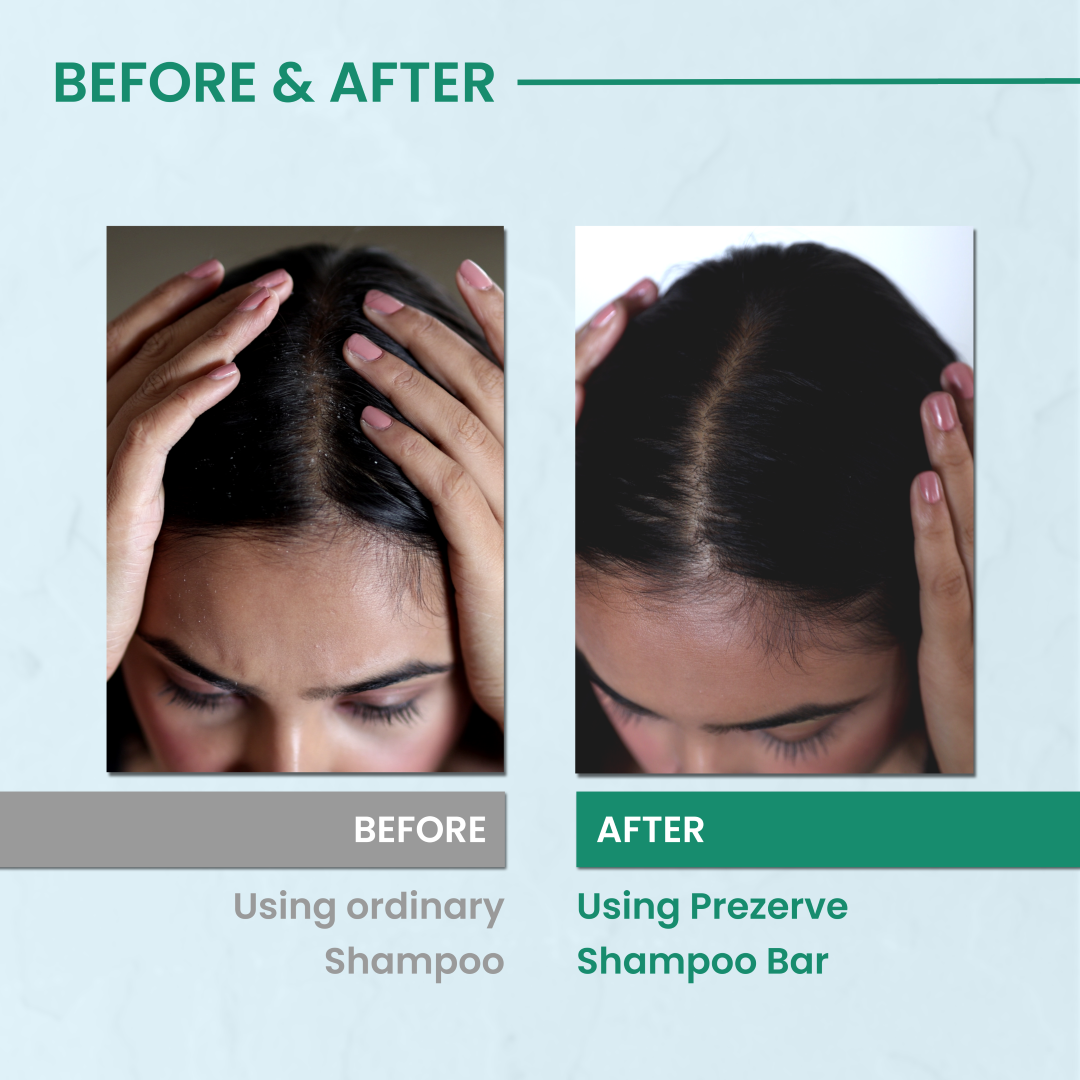 Prezerve Clarifying Mini Shampoo Bar for Oily and Dandruff -Prone Hair